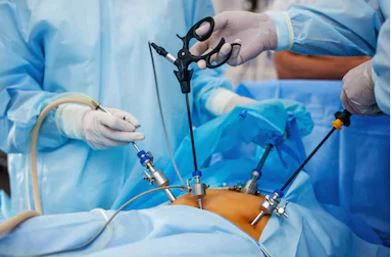 استخدام وصيانة بالمنظار